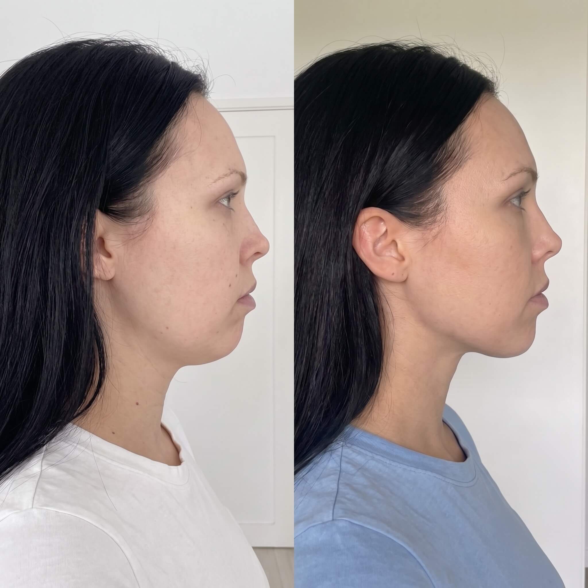 Kit Masajeador Facial