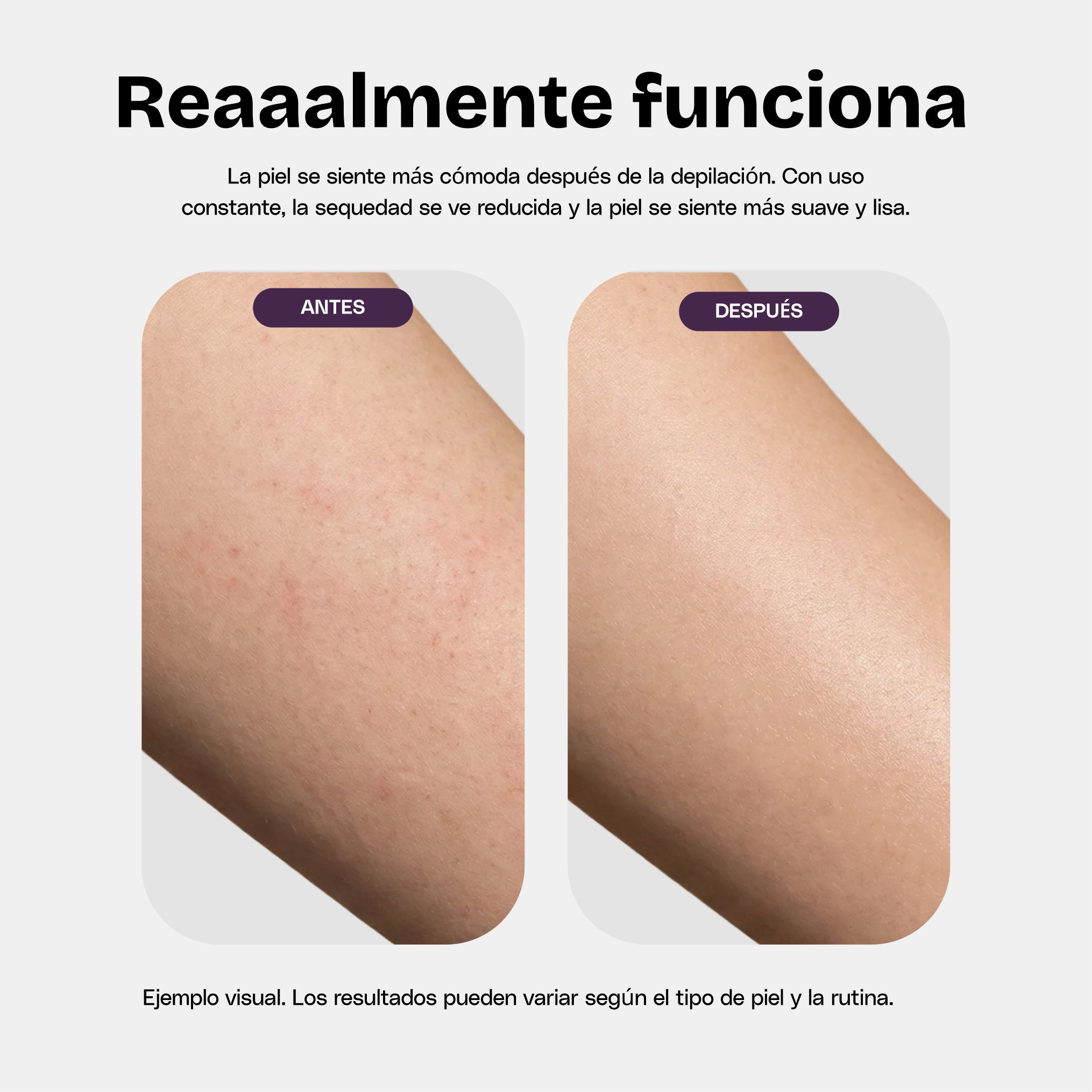 Crema Humectante 5 en 1 Post-Depilatoria (200ml)
