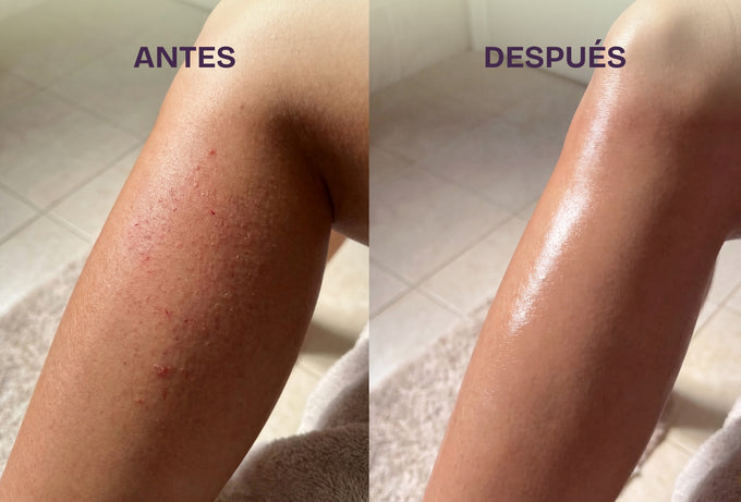 La Piel No Te Arde, No Te Pica Al Otro Día Ni Te Queda Llena De Puntitos Rojos
